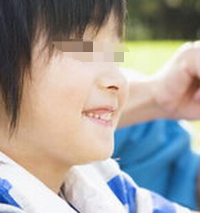 武汉儿童白斑病可以治愈的吗？